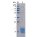 Human TIGIT Protein, His Tag – Figure 1 of 1