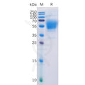 Human CB1 (1-116) Protein, hFc Tag – Figure 1 of 1