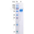 Human CB1 Protein, hFc Tag – Figure 1 of 1