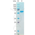 SARS-CoV-2 (Alpha) S protein RBD , hFc Tag – Figure 1 of 1