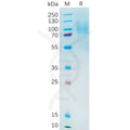 Human YAP1 Protein, His Tag – Figure 1 of 1