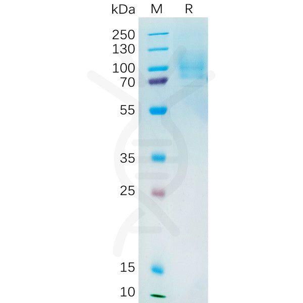 Human YAP1 Protein, His Tag – Figure 1 of 1