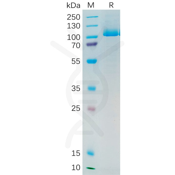 Human PSMA Protein, His Tag – Figure 1 of 1