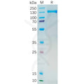 Human PSMA Protein, mFc Tag – Figure 1 of 1
