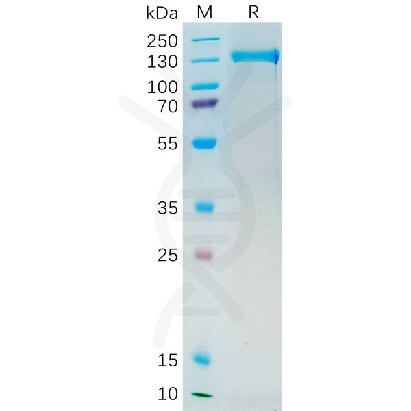 Human PSMA Protein, mFc Tag – Figure 1 of 1