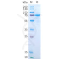 Human IL15RA Protein, hFc Tag – Figure 1 of 1