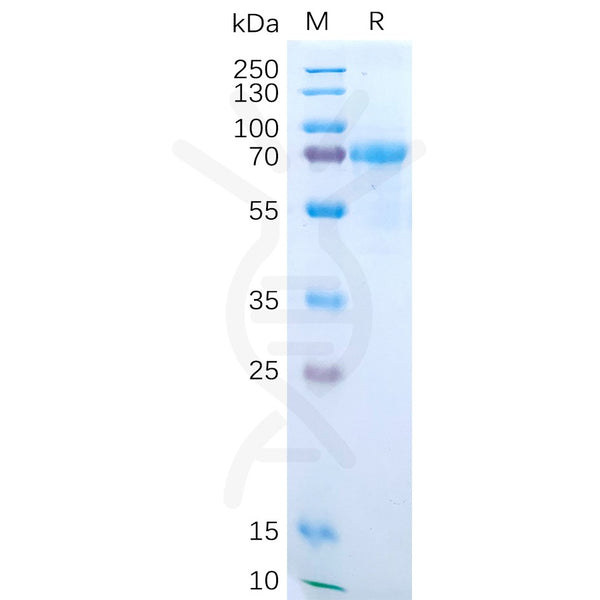 Human IL15RA Protein, hFc Tag – Figure 1 of 1