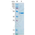 Human IL21 Protein, mFc Tag – Figure 1 of 1