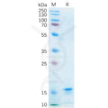 Human IL21 Protein, His Tag – Figure 1 of 1
