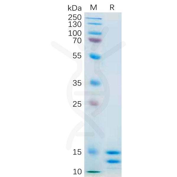 Human IL2 Protein, His Tag – Figure 1 of 1