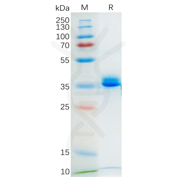 Mouse GPRC5D Protein, hFc Tag – Figure 1 of 1