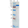 Human PCSK9 Protein, hFc Tag – Figure 1 of 1