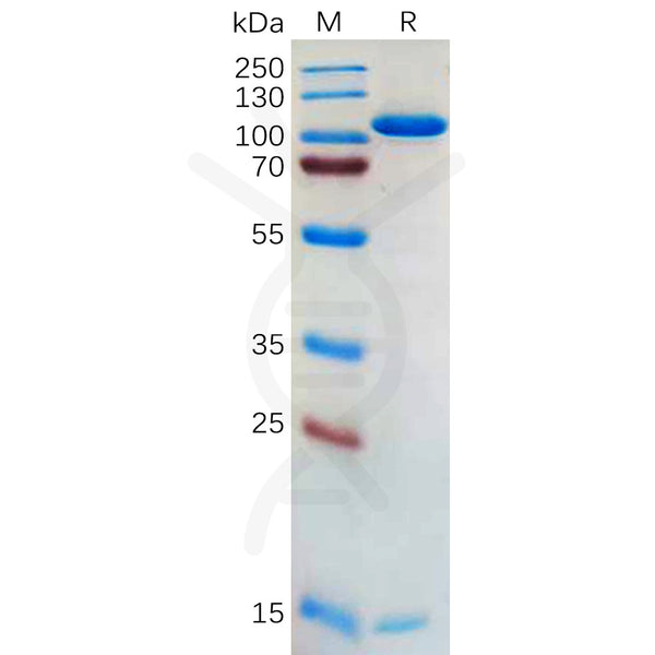 Human PCSK9 Protein, hFc Tag – Figure 1 of 1