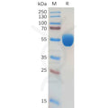 Human GM-CSF Protein, hFc Tag – Figure 1 of 1