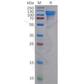 Human APP Protein, His Tag – Figure 1 of 1