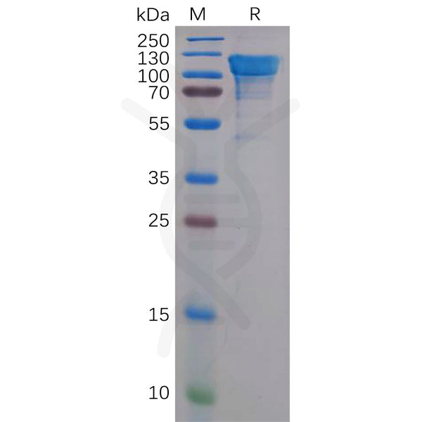 Human APP Protein, His Tag – Figure 1 of 1
