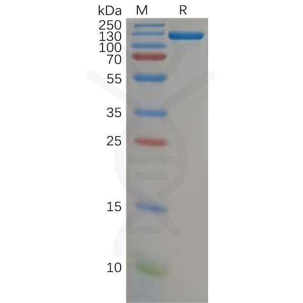 Human CFB Protein, hFc Tag – Figure 1 of 1