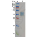 Human IL21R Protein, His Tag – Figure 1 of 1