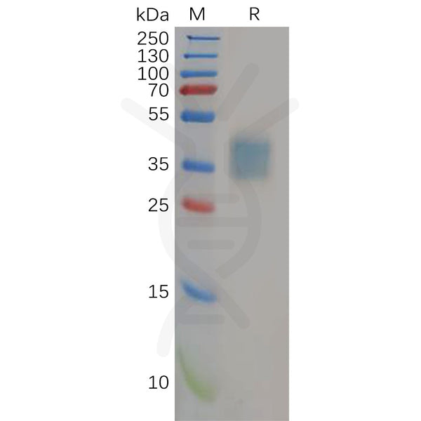 Human IL21R Protein, His Tag – Figure 1 of 1