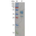 Human MDR-1 Protein, hFc Tag – Figure 1 of 1
