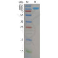 Human CD26 (29-766) Protein, His Tag – Figure 1 of 1
