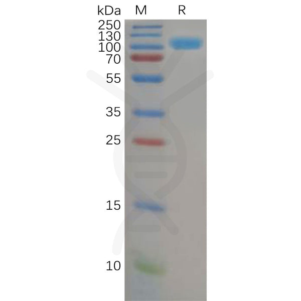 Human CD26 (29-766) Protein, His Tag – Figure 1 of 1