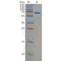 Human ALB Protein, His Tag – Figure 1 of 1