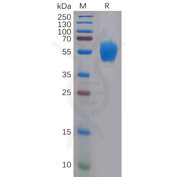 Human FGFR4 Protein, His Tag – Figure 1 of 1