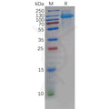 Human CDCP1 Protein, His Tag – Figure 1 of 1