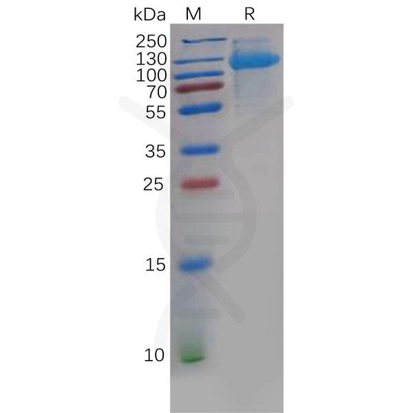 Human CDCP1 Protein, His Tag – Figure 1 of 1