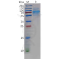 Human CLEC14A Protein, His Tag – Figure 1 of 1