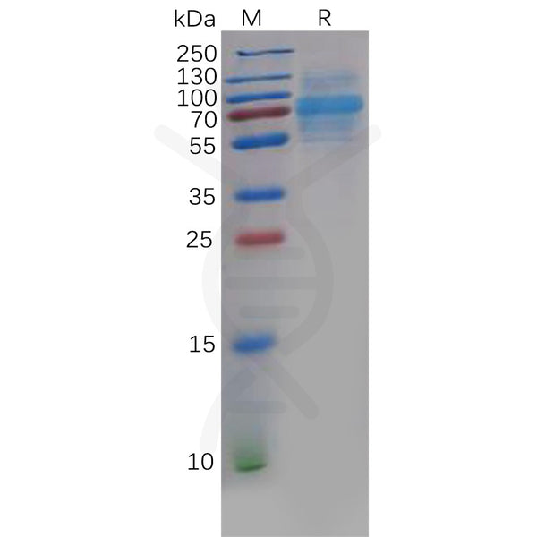 Human CLEC14A Protein, His Tag – Figure 1 of 1