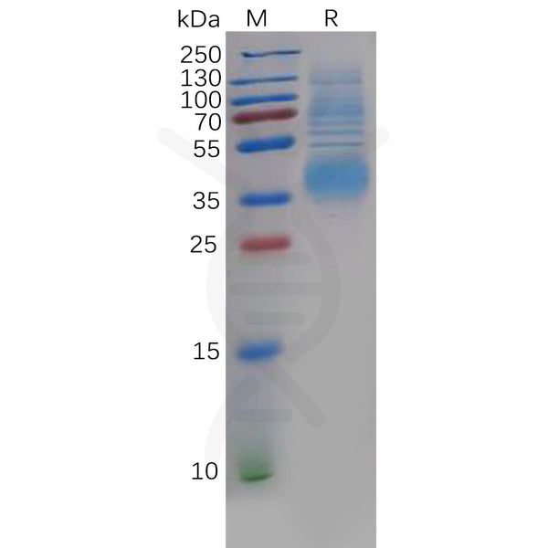 Human CLU Protein, His Tag – Figure 1 of 1