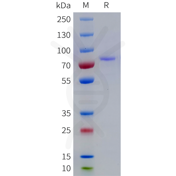 Human GAS6 Protein, His Tag – Figure 1 of 1