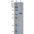 Human CHI3L1 Protein, His Tag – Figure 1 of 1