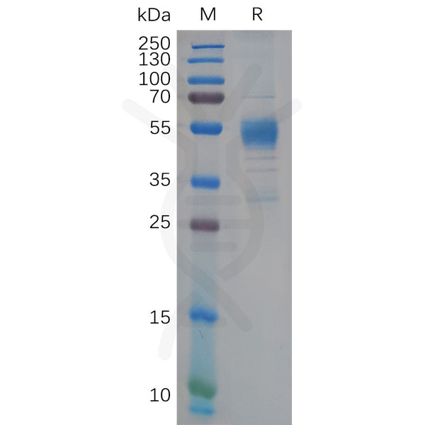 Human TREM2 Protein, hFc Tag – Figure 1 of 1