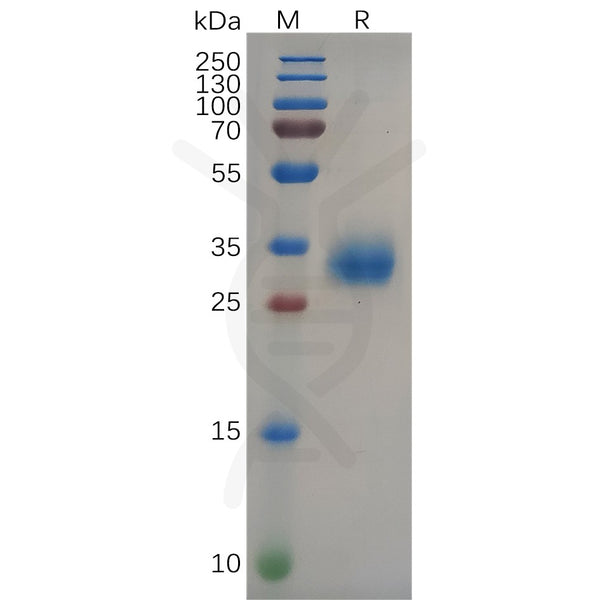 SARS-CoV-2 (Delta) S protein RBD, His Tag – Figure 1 of 1