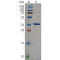 Human NEFL (89-400) Protein, His Tag – Figure 1 of 1