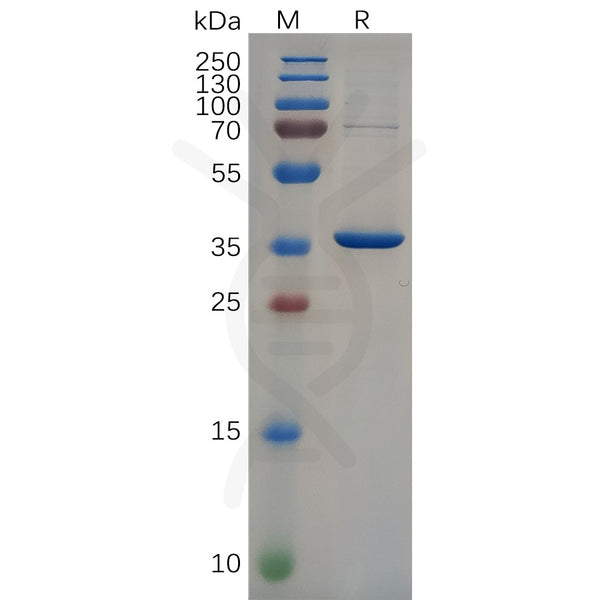 Human NEFL (89-400) Protein, His Tag – Figure 1 of 1