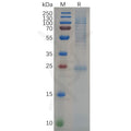 Human KRAS Protein, His Tag – Figure 1 of 1
