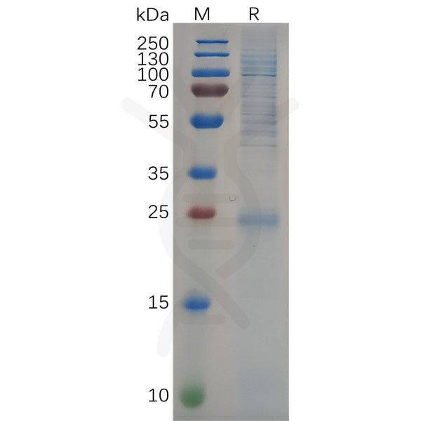 Human KRAS Protein, His Tag – Figure 1 of 1