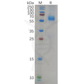 SARS-CoV-2 (Delta) Nucleocapsid, C-His Tag – Figure 1 of 1