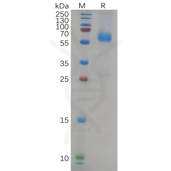 SARS-CoV-2 (Delta) Nucleocapsid, C-His Tag – Figure 1 of 1