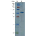 Human GFAP (68-377) Protein, His Tag – Figure 1 of 1