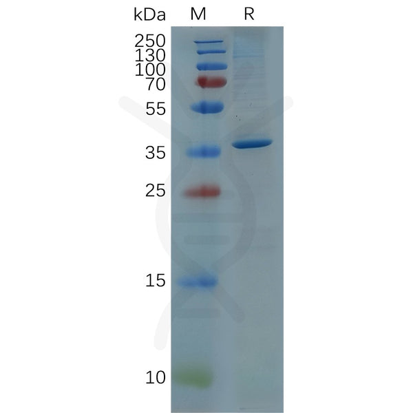 Human GFAP (68-377) Protein, His Tag – Figure 1 of 1