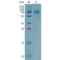 Human CD166 Protein, His Tag – Figure 1 of 1
