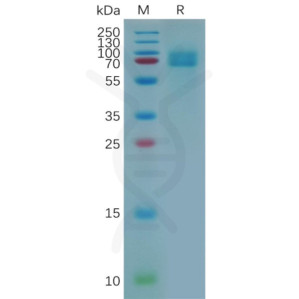Human CD166 Protein, His Tag – Figure 1 of 1