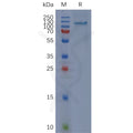 Human CD93 Protein, mFc Tag – Figure 1 of 1