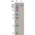 Human NCL Protein, His Tag – Figure 1 of 1