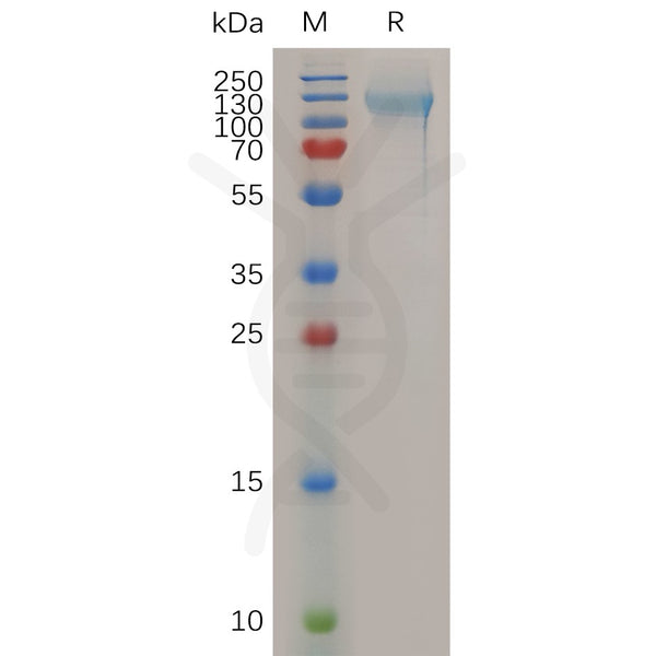 Human NCL Protein, His Tag – Figure 1 of 1